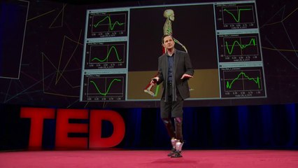 Bionics human parts that let people to dance and run