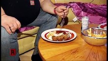 Dokumentation über Magen- Wiederherstellungsoperationen Teil1