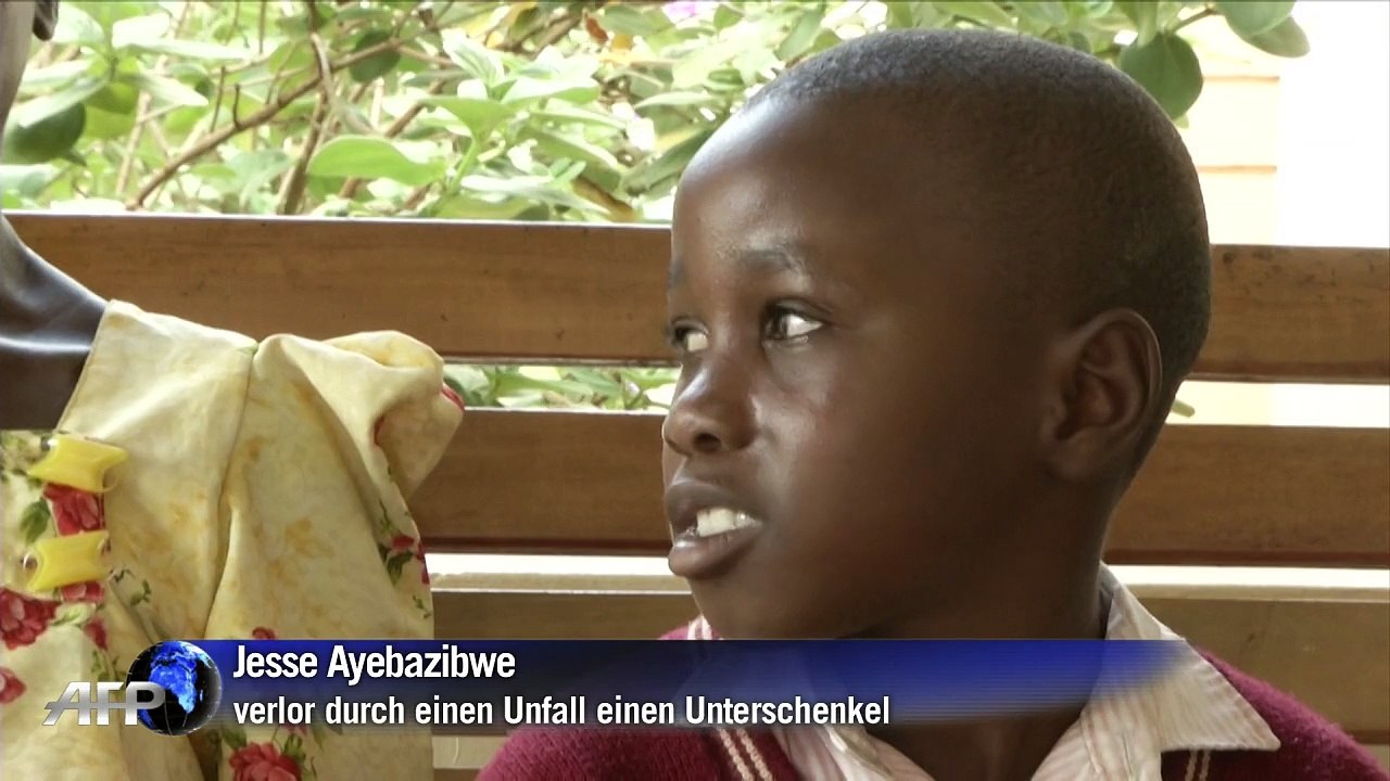 3-d-technik ermöglicht amputierten kindern neues leben
