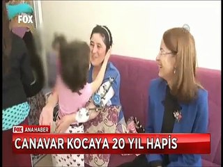 Pompalı tüfekle eşini yaralayıp iki bacağından eden canavar kocaya 20 yıl hapis