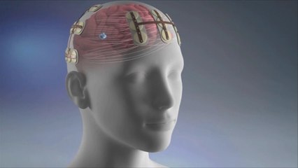 المجال الكهرومغناطيسي يمنع تكاثر خلايا السرطان بالدماغ