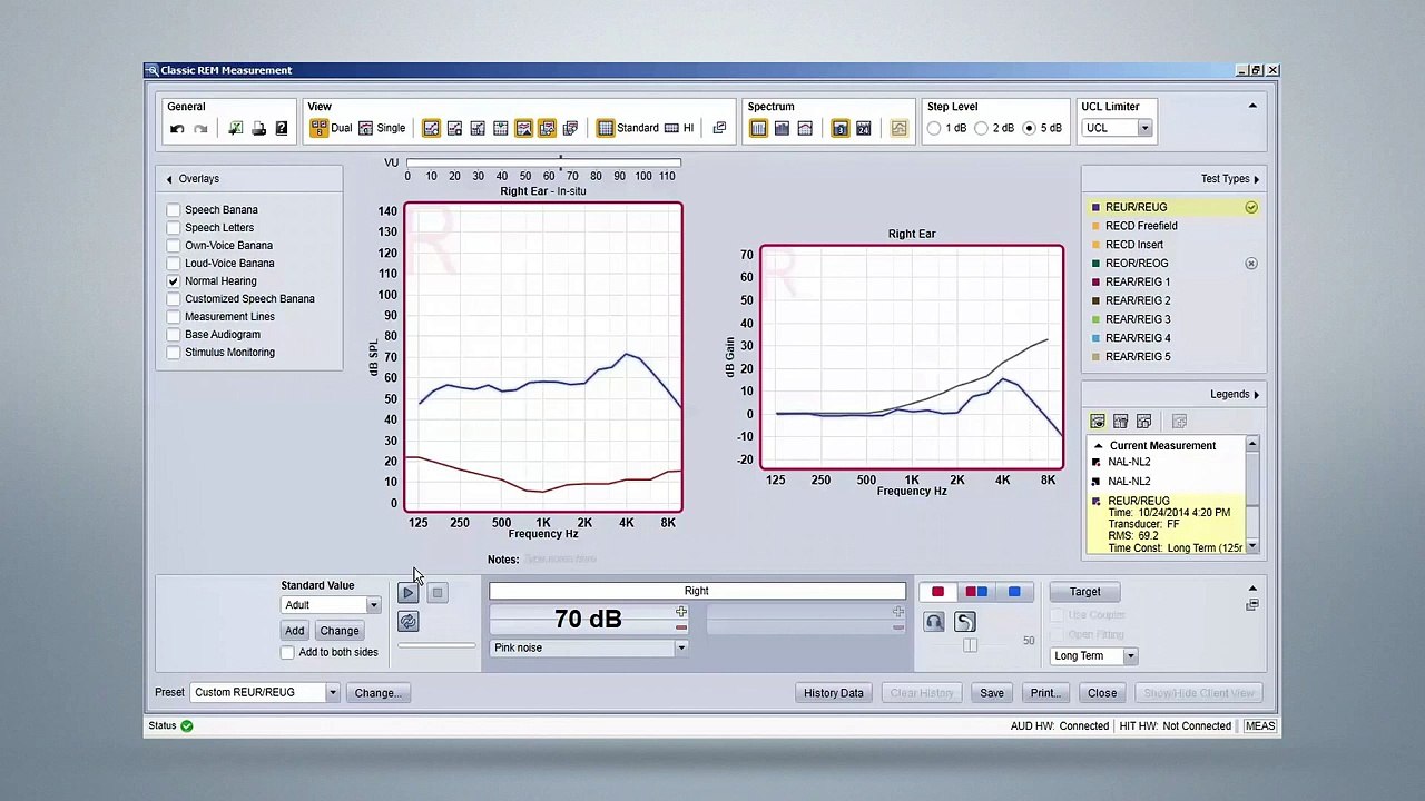 Siemens Unity 3 Real Ear Measurement - Tutorial