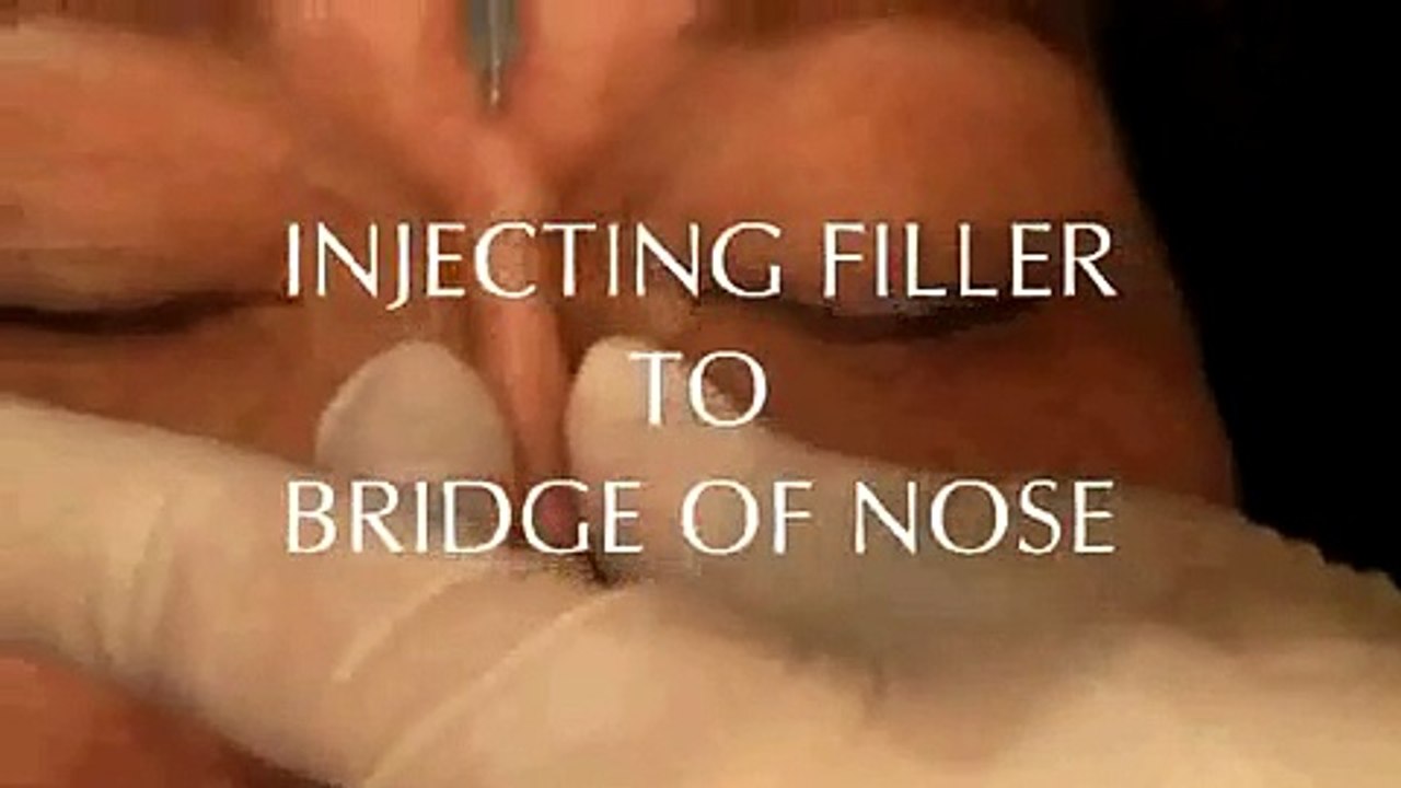 FACIAL/ SLIMMING/ LOSE WEIGHT/ DETOX/ BOTOX