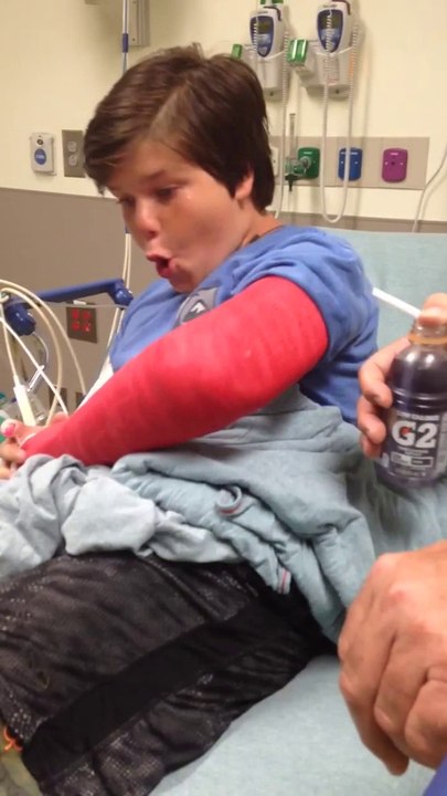 Kid broke his arm and gets crazy on painkillers