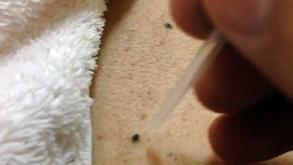 H.GAZİ ROYAL KOMBİ SERVİSİ-0312-279-15-16