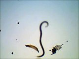 A Very Active Nematode Worm - Necator Americanus