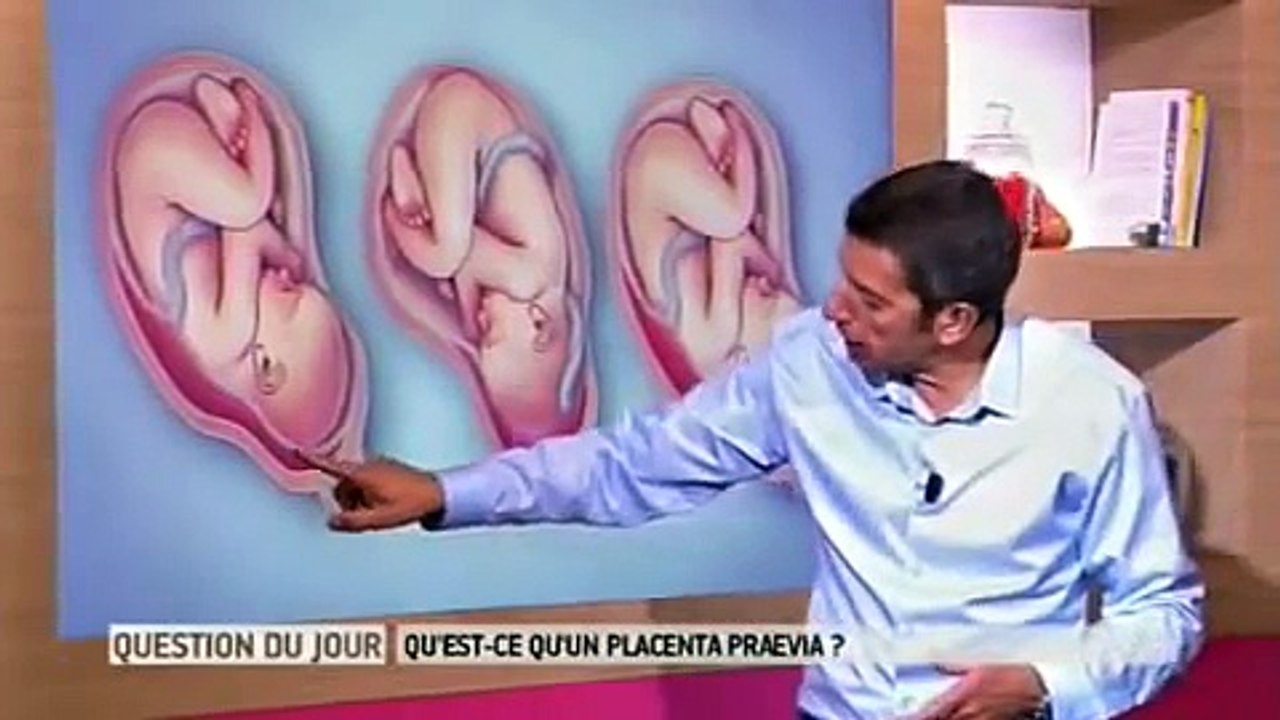 placenta praevia