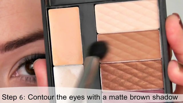 phau thuat nang nguc noi soi cho bo nguc quyen ru thuong thay