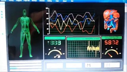 Quantum Resonance Magnetic Analyzer (QRMA) is a crap!!! DONT BUY IT!!