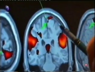 El orgasmo femenino (RMf): Barry Komisaruk