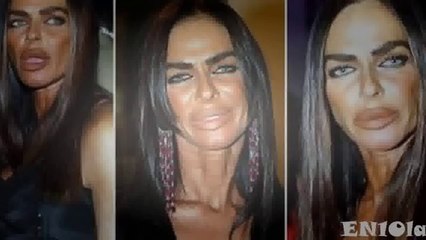 Dünyanın En Kötü 10 Estetik Ameliyatı Olan Kadınları