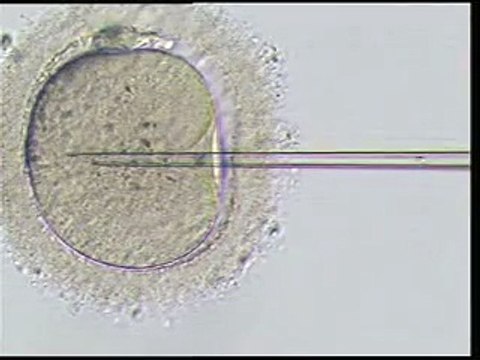 about infertility and ivf threatments icsi video.flv turkey-ivf.com