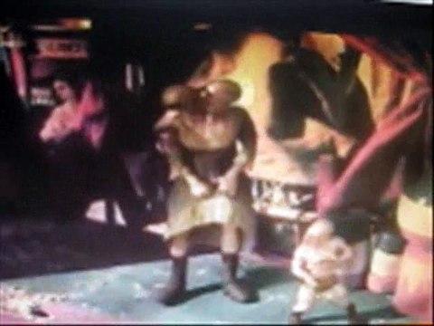 Цирковые уроды. Девушка-пингвин