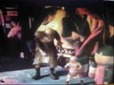 Цирковые уроды. Женщина со слоновьей кожей