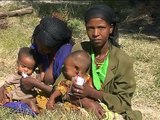 1 Introduction - Amharic - Management of Severe Acute Malnutrition