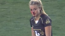 Tough rugby player breaks nose, continues to make tackles