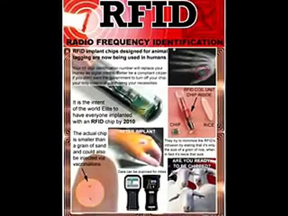 Aaron Russo RFID Human Implant Chip