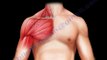 Shoulder Pain - Everything You Need To Know - Dr. Nabil Ebraheim