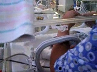 Nasty Nasal Gastric Tube (NGT) insertion