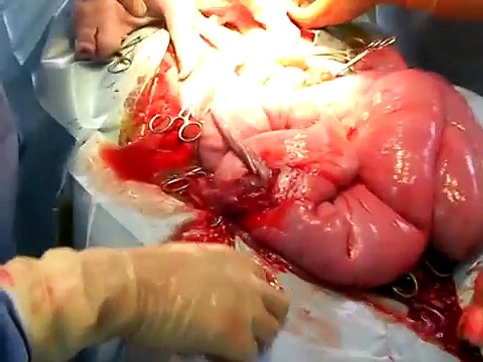 Cesarean birth of transgenic clone pig in TG lab of ATIT Taiwan(20080430)