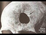 Who shot the neandherthal man? Kabwe Skull (Ancient Aliens)