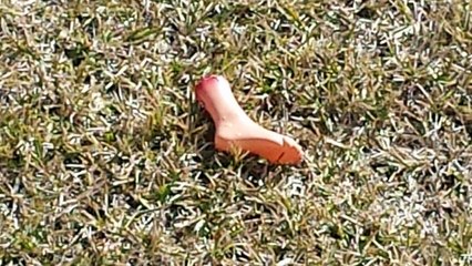 I Lost My Foot and Hands - Help!