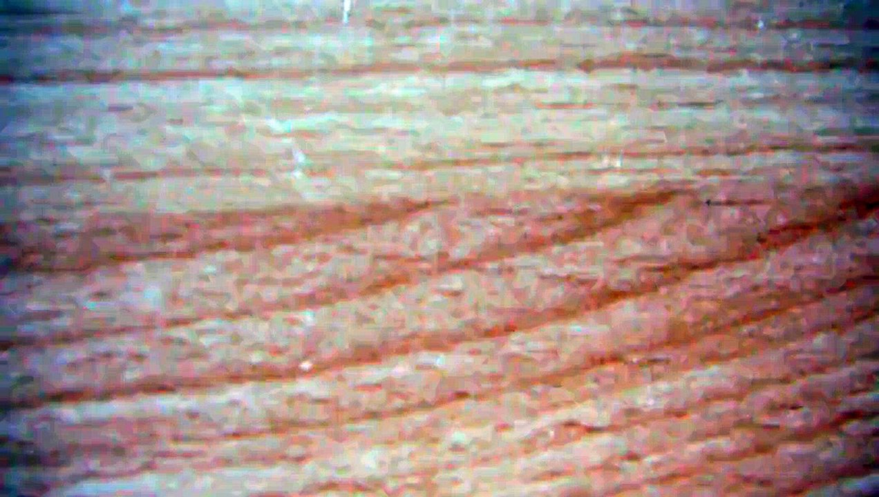 la plongé et la contre plongé