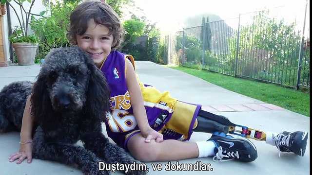 Tek Bacağı Olmayan 9 Yaşındaki Ezra'nın Büyüleyici Hikayesi