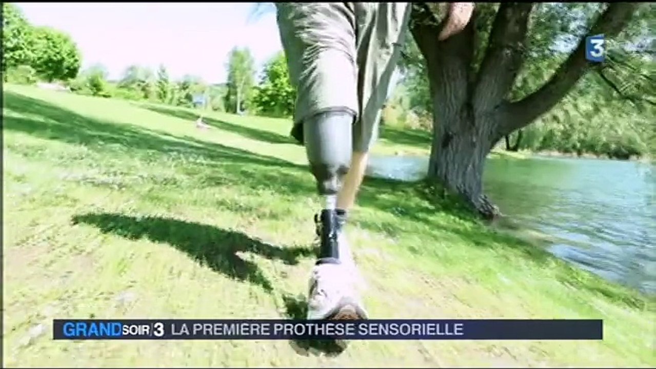 Une prothèse "connectée" va changer le quotidien des amputés