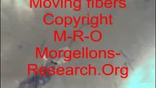 Moving Morgellons fibers