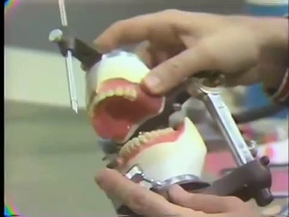 Posterior Teeth - Balanced Occlusion