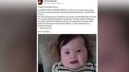 Mom's emotional Facebook post about Down syndrome goes viral