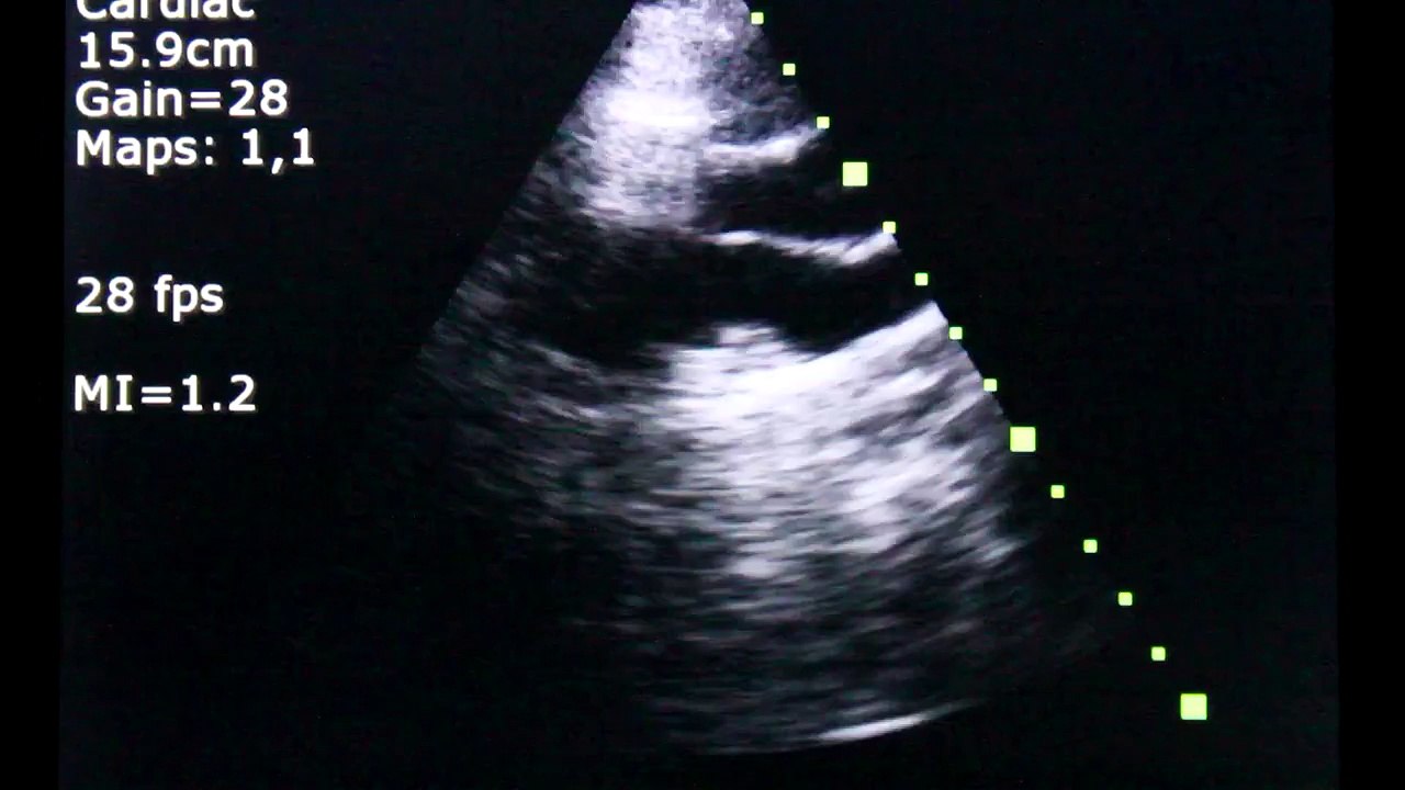 My Heart Ultrasound