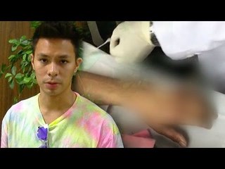 Fero Walandouw Lepas Benang Jahitan - Hot Shot 28 Desember 2014