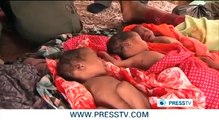 Somali woman gives birth to quadruplets