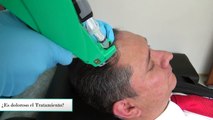 Tratamiento Calvicie o Alopecia con Testimonio con Resultados Naturales con Cabello más grueso