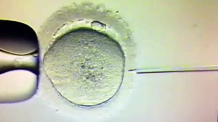 Fecundación in vitro Barcelona