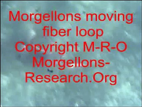 Morgellons red moving fiber loop