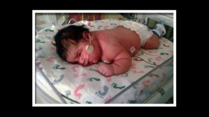 600 POUND WOMAN GIVES BIRTH TO 40 POUND BABY