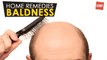 Baldness - Home Remedies | Health Tips
