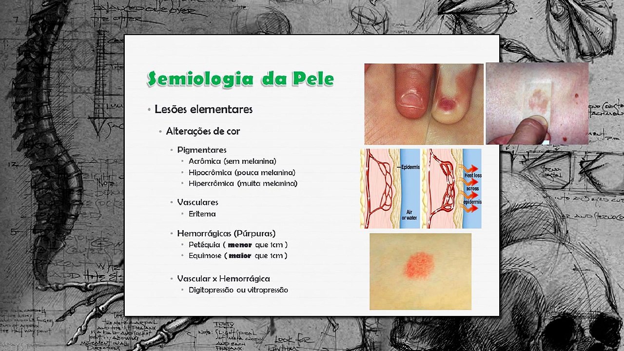 #MR Semiologia - Lesões elementares da pele