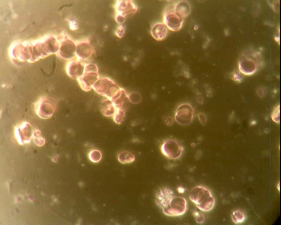 Dunkelfeld-Mikroskop mit Blut