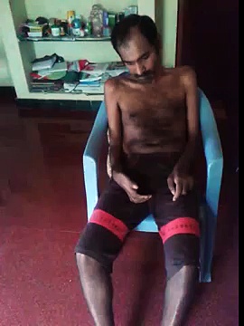 motor neuron disease treatment in varma treatment