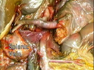 24 Art de Órganos Abdominales II Mesentérica Superior e Inferior)