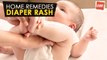 Diaper Rash - Home Remedies | Health Tips