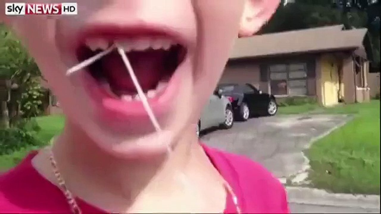 il enlève sa dent avec une chevrolet !!!!!!!!!!!