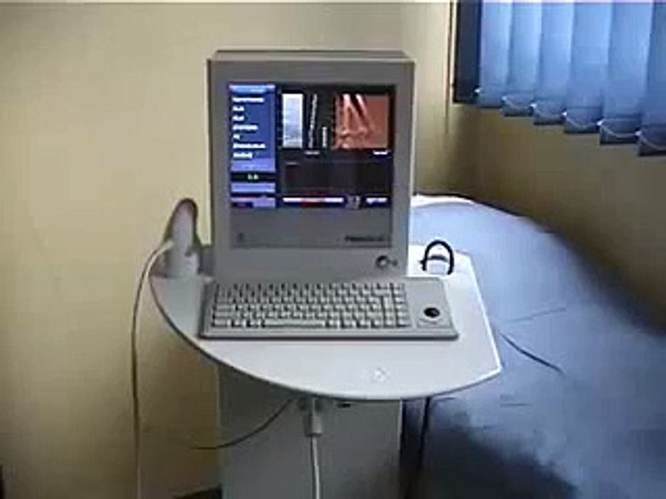 Fibroscan