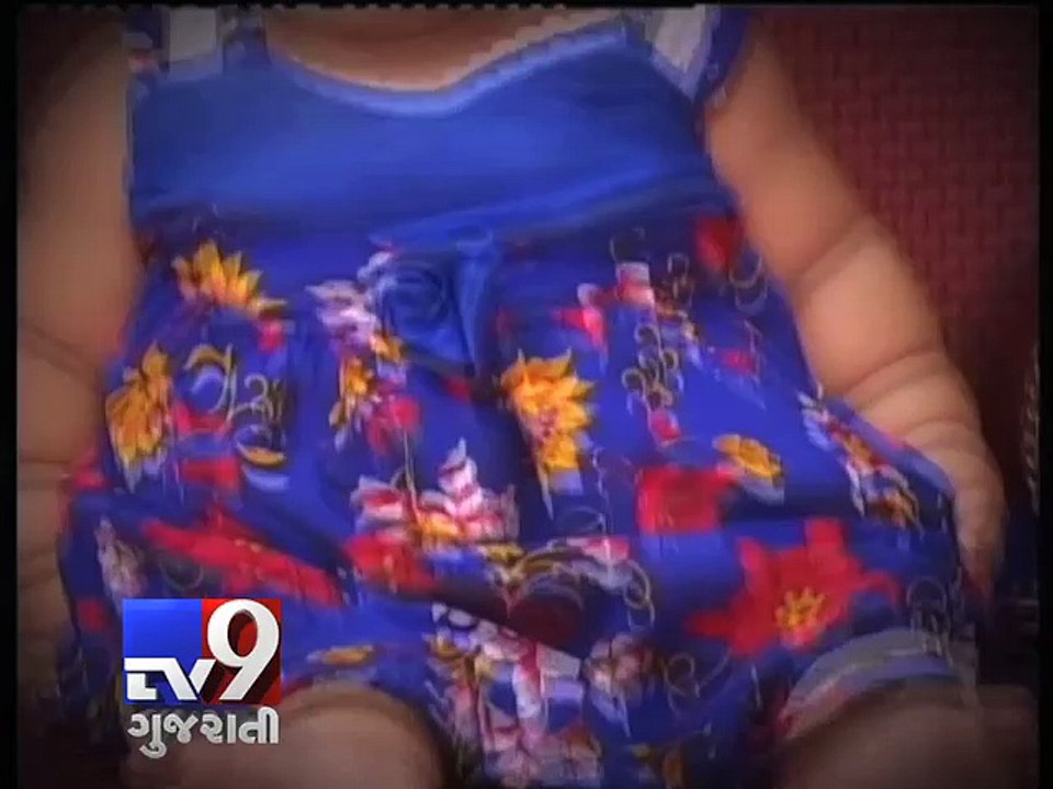 Health concerns over city's fattest baby in Mumbai - Tv9 Gujarati