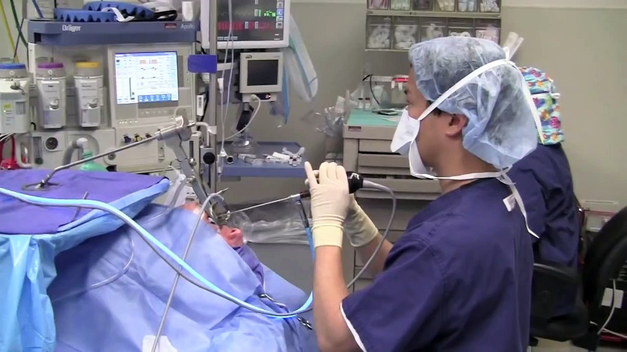 Zenker's Diverticulum Surgery Endoscopic Staple Diverticulostomy