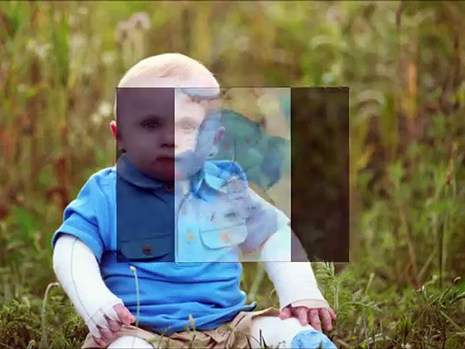 Epidermolysis Bullosa Awareness Week 2012 - DO SOMETHING